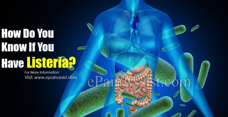 How Do You Know If You Have Listeria?