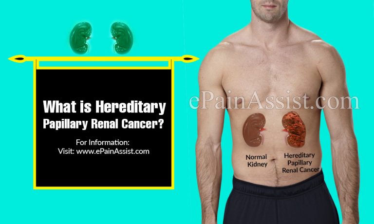 What is Hereditary Papillary Renal Cancer & How is it Treated?