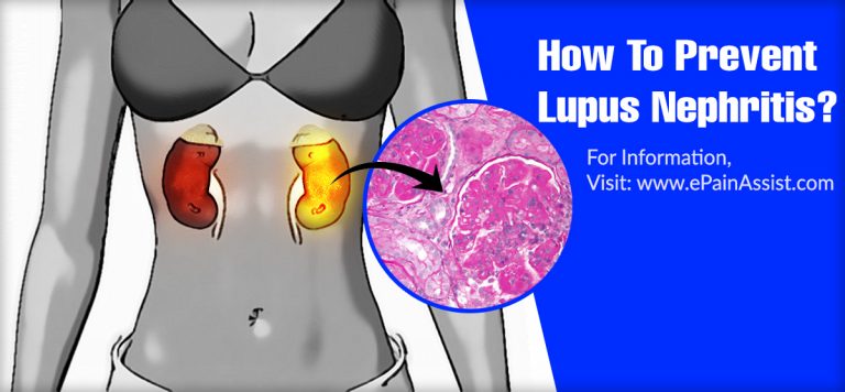 How To Prevent Lupus Nephritis?