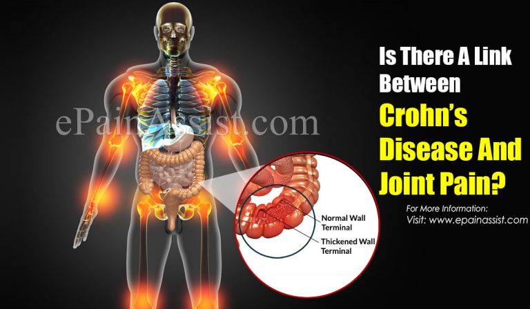 Is There A Link Between Crohn’s Disease And Joint Pain?