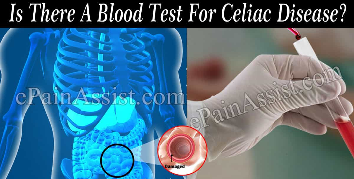 Is There A Blood Test For Celiac Disease?