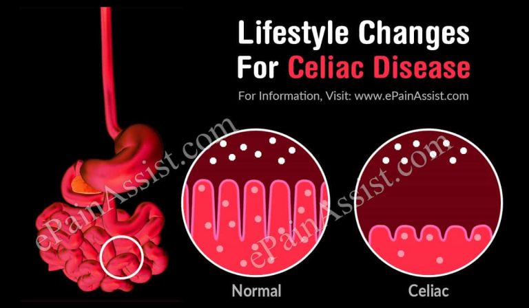Lifestyle Changes For Celiac Disease