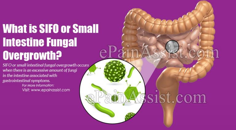 What is SIFO or Small Intestine Fungal Overgrowth: Causes, Symptoms, Treatment, Diet, Diagnosis