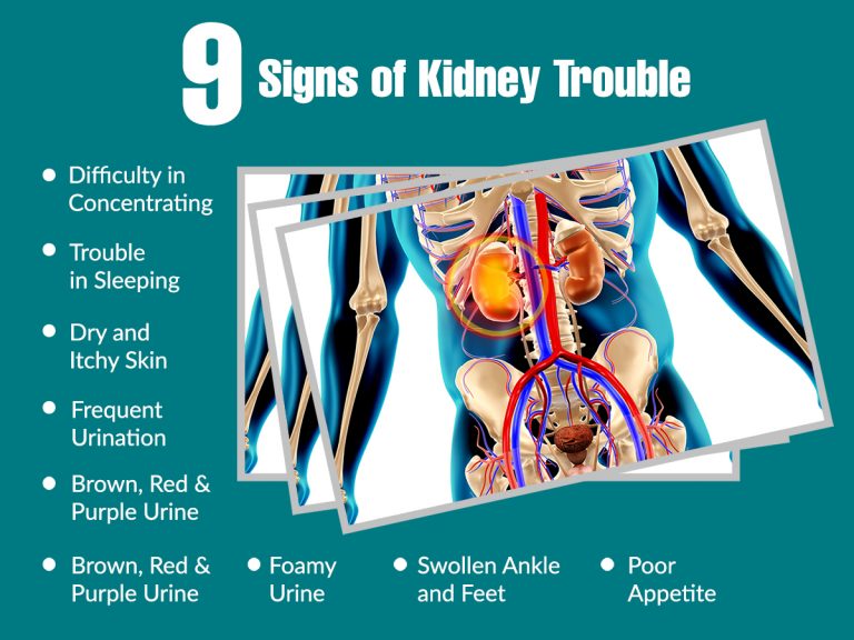 9 Signs of Kidney Trouble