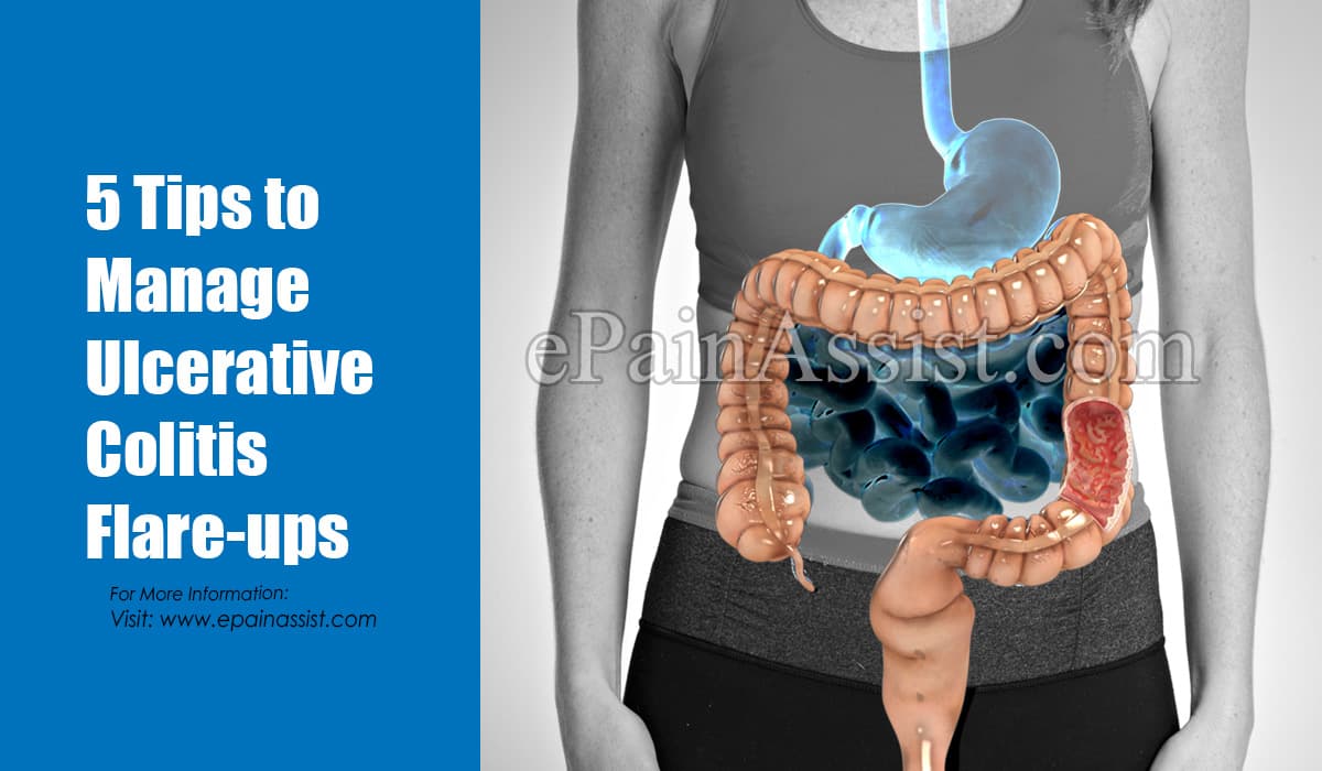 5 Tips to Manage Ulcerative Colitis Flare-ups