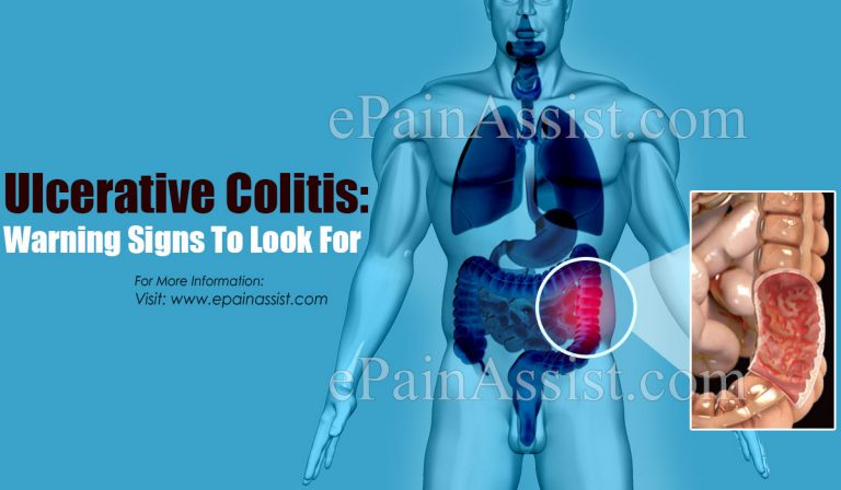 Ulcerative Colitis: Warning Signs To Look For