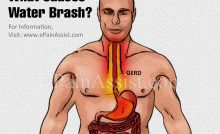 Can Acid Reflux Give You Diarrhea And Vomiting can acid reflux give you diarrhea and
