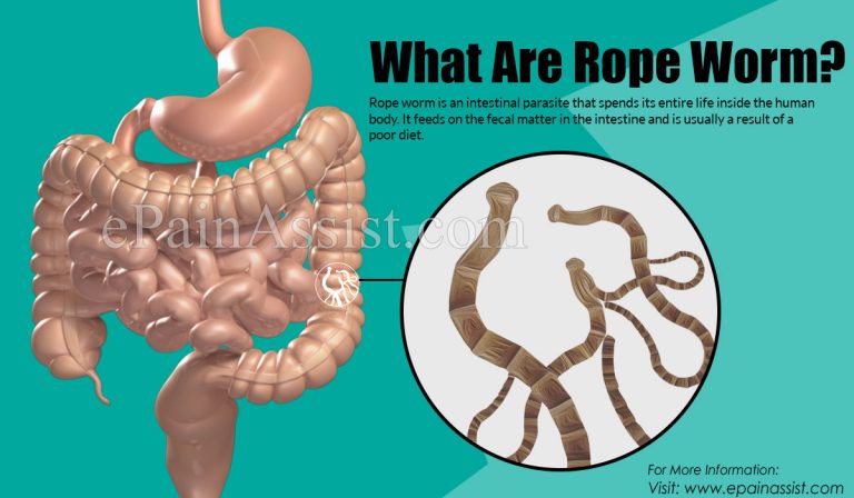What Are Rope Worms: Symptoms, Treatment, Prevention, Diagnosis