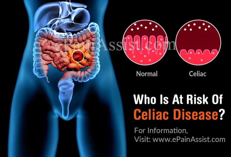 Who Is At Risk For Celiac Disease & Is There A Blood Test For It?