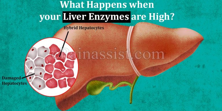 What Happens when your Liver Enzymes are High?