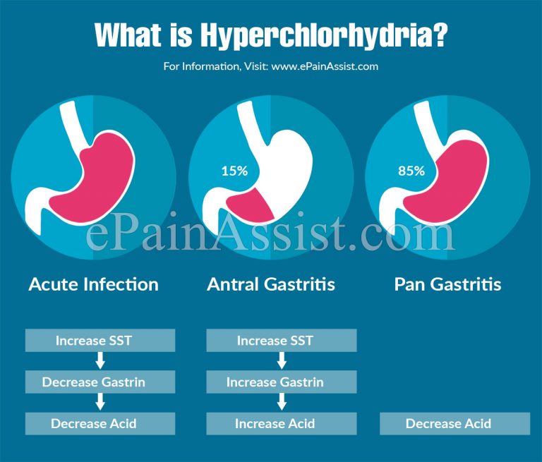 What is Hyperchlorhydria: Causes, Symptoms, Treatment, Diagnosis, Risks