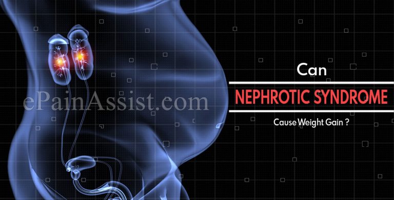 Can Nephrotic Syndrome Cause Weight Gain & Why Do You Get Salt Restrictions In It?