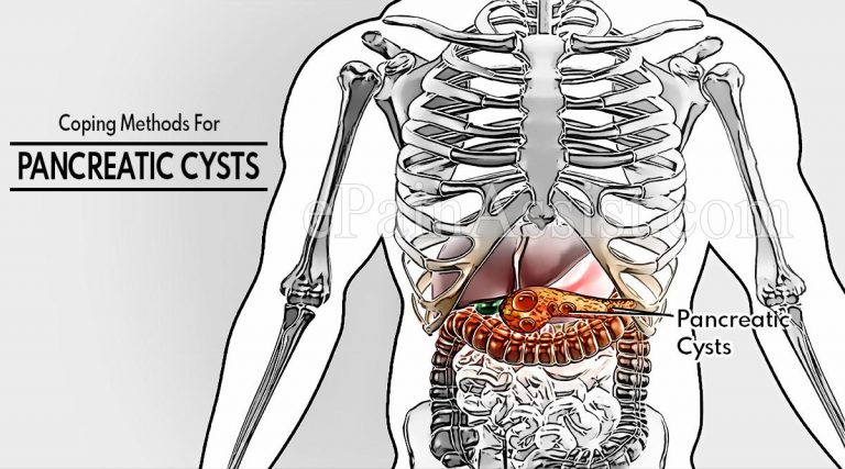 Coping Methods For Pancreatic Cysts
