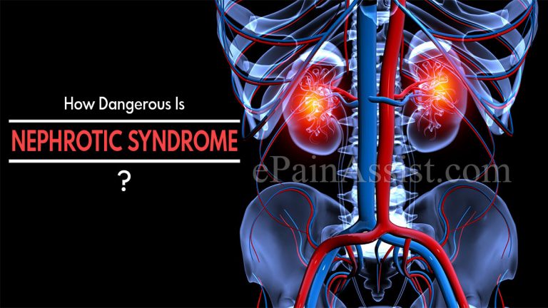 How Dangerous Is Nephrotic Syndrome & Is It Contagious?