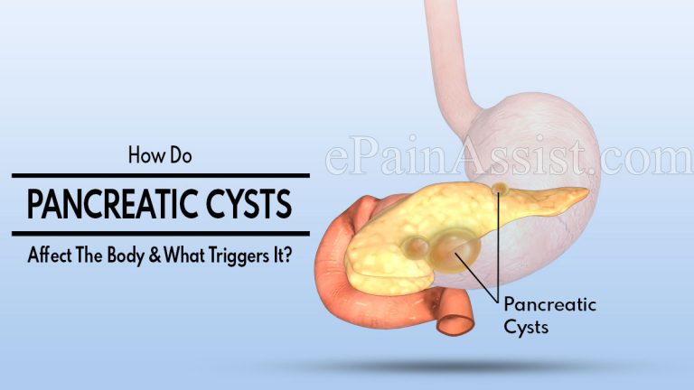 How Do Pancreatic Cysts Affect The Body & What Triggers It?