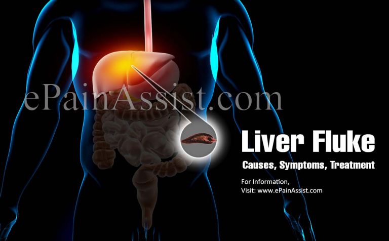 Liver Fluke: Causes, Symptoms, Treatment