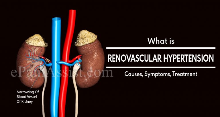 Renovascular Hypertension: Causes, Symptoms, Treatment, Complications, Diagnosis