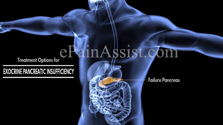 Treatment Options for Exocrine Pancreatic Insufficiency