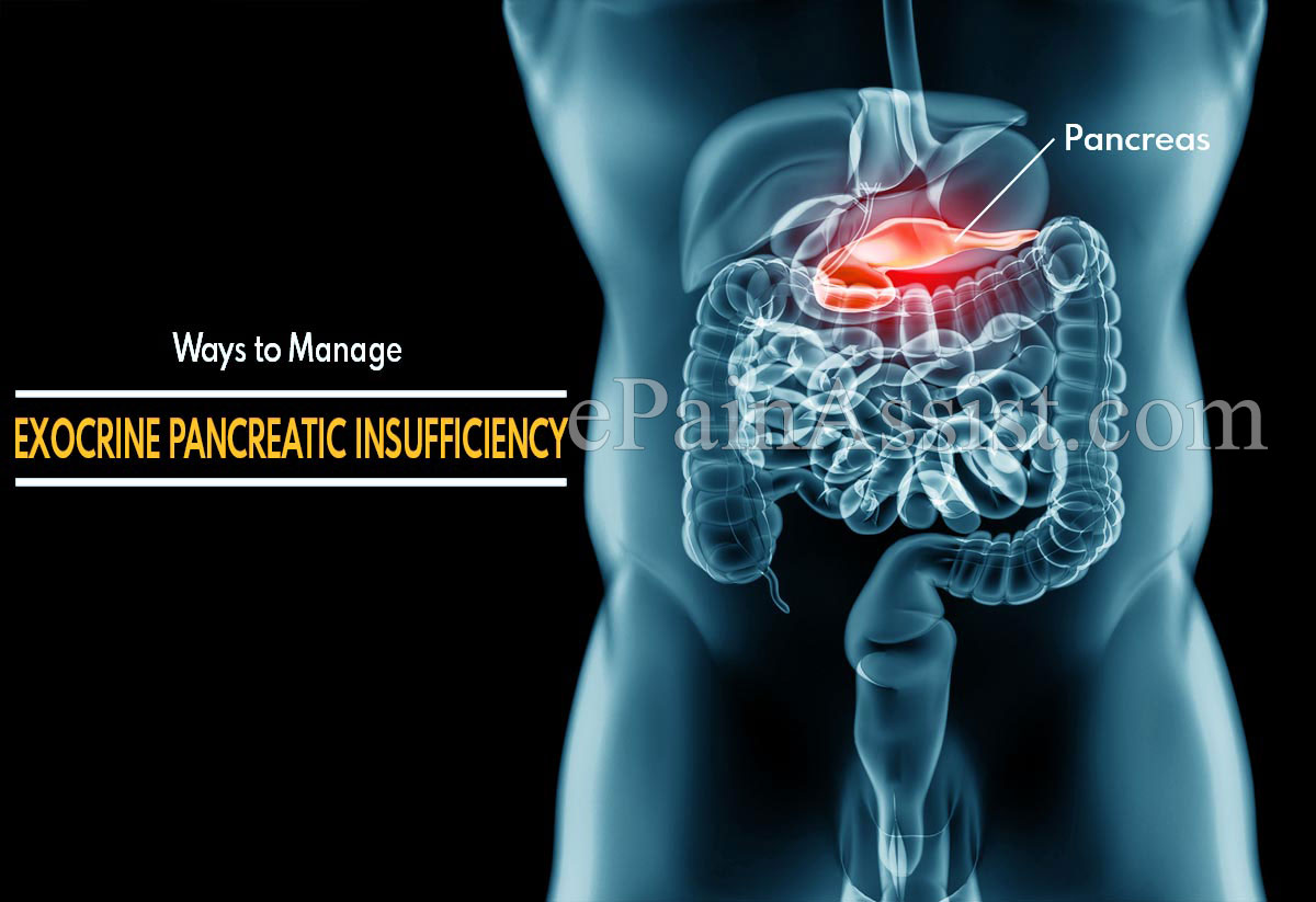 Ways to Manage Exocrine Pancreatic Insufficiency