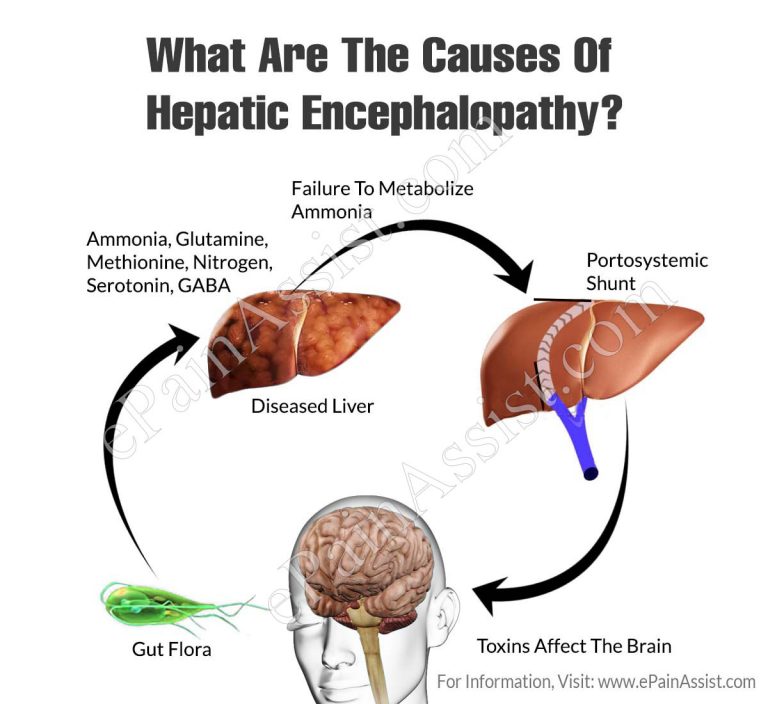 What Are The Causes Of Hepatic Encephalopathy?