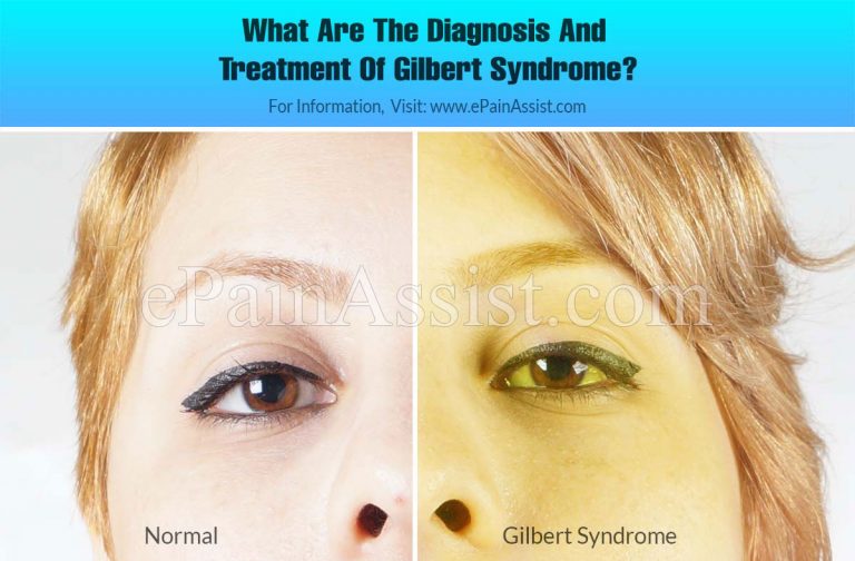 What Drugs To Avoid When You Have Gilbert Syndrome?