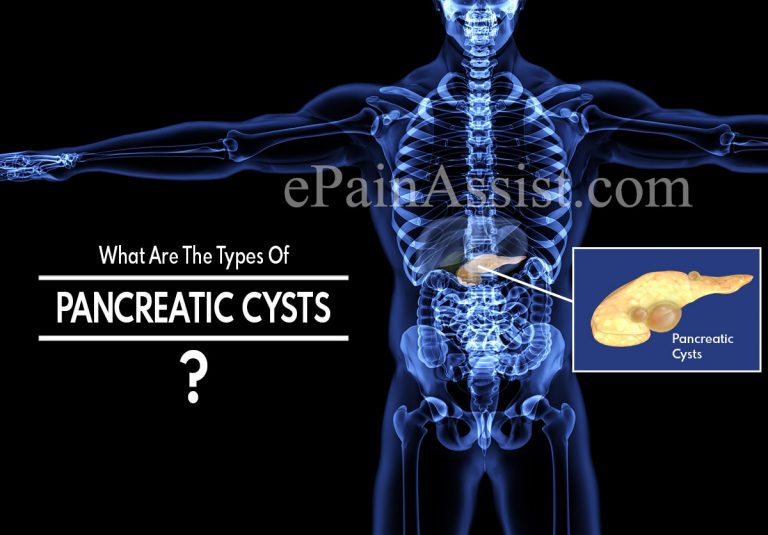 What Are The Types Of Pancreatic Cysts & How Do You Remove A Pancreatic Cyst?