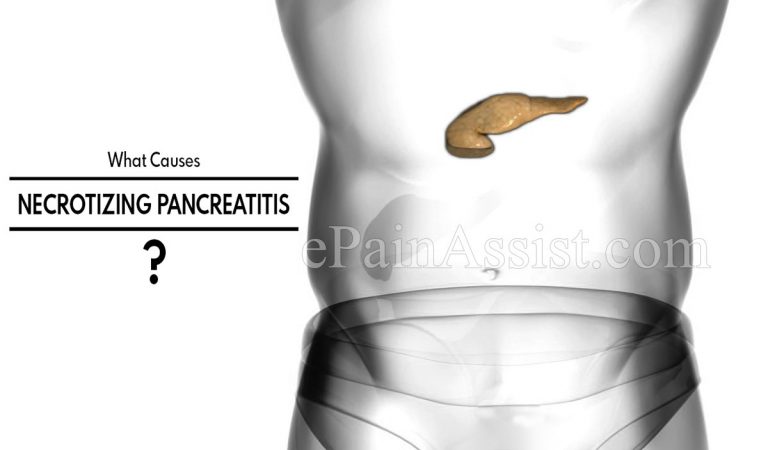 What Causes Necrotizing Pancreatitis & How is it Treated? | Symptoms and Diagnosis of Necrotizing Pancreatitis