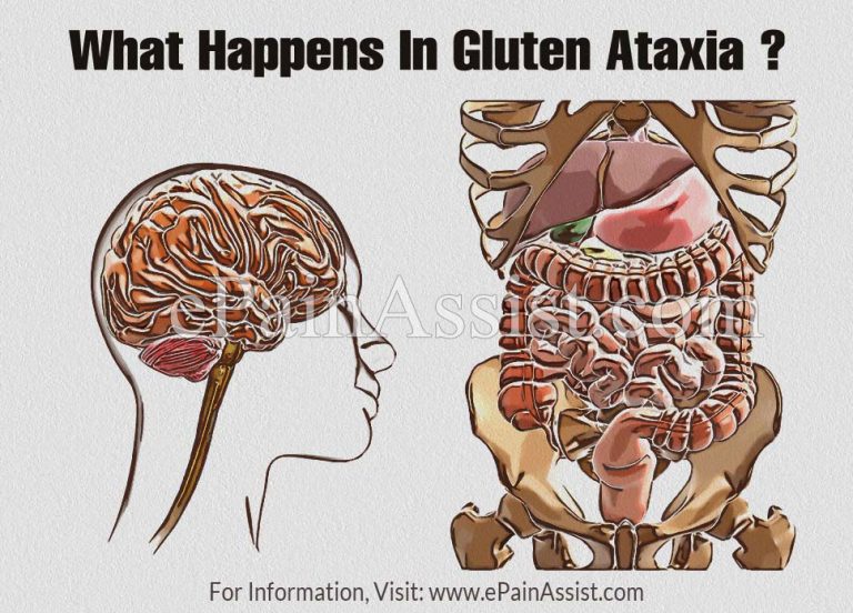 What Happens In Gluten Ataxia , Know the Symptoms, Diagnosis and Treatment of Gluten Ataxia