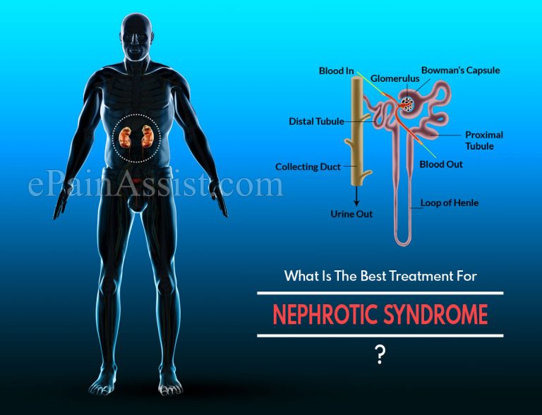 What Is The Best Treatment For Nephrotic Syndrome?