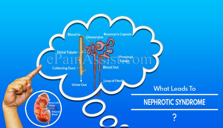 What Leads To Nephrotic Syndrome & Can It Be Cured?