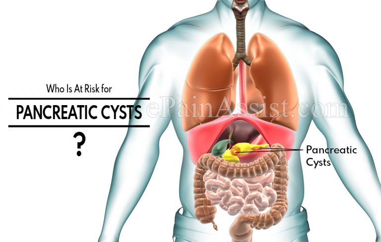 Who Is At Risk for Pancreatic Cysts & How Is Its Biopsy Done?