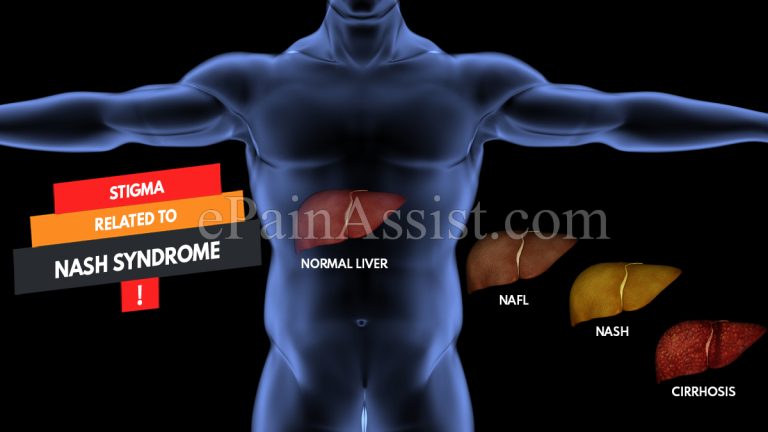 Stigma Related to NASH Syndrome