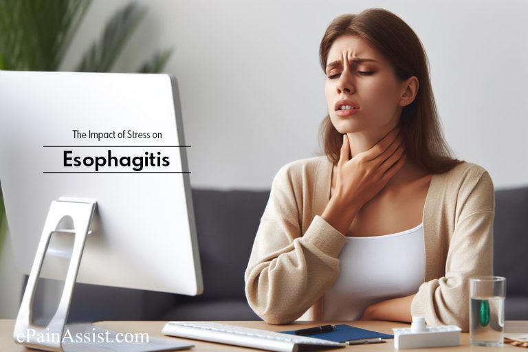 The Impact of Stress on Esophagitis : Insights and Management Strategies