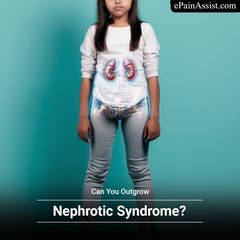 Can You Outgrow Nephrotic Syndrome & How Do You Reduce Swelling In It?
