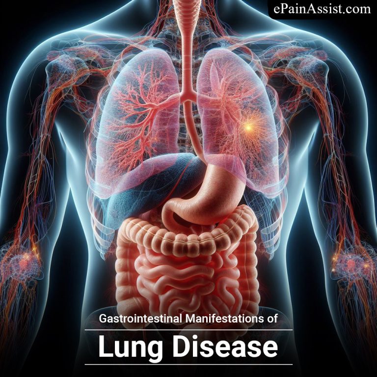 Gastrointestinal Manifestations of Lung Disease : Unraveling the Intestinal-Lung Connection