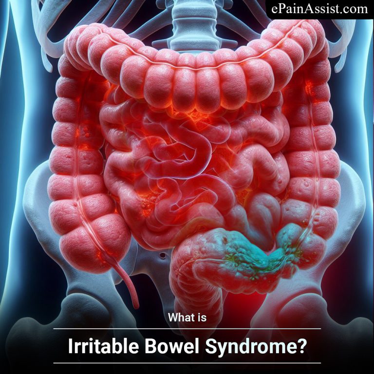 Gallbladder Removal and Its Link to Irritable Bowel Syndrome : What You Need to Know
