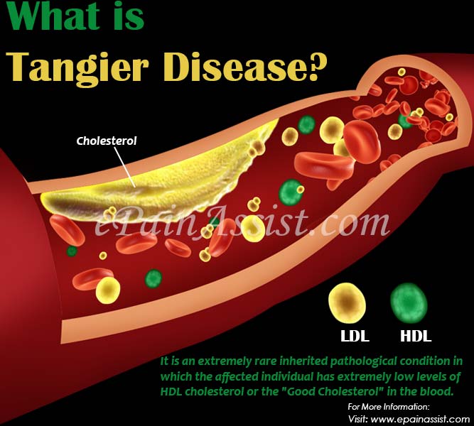 What Is Tangier Disease?
