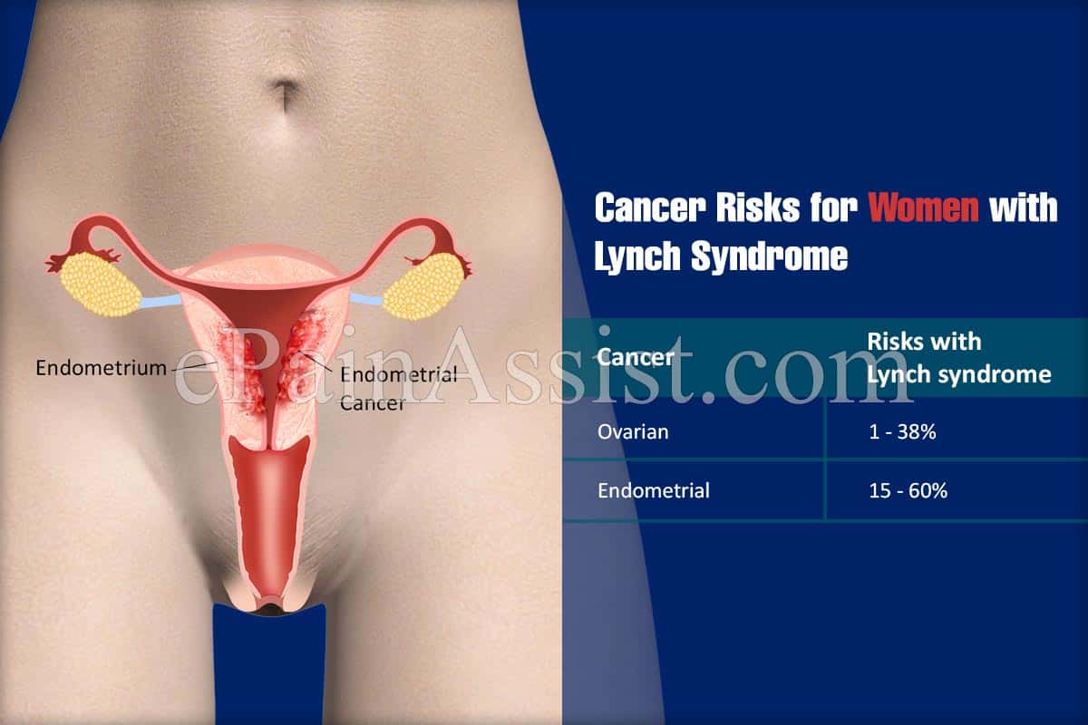 Cancer risks for women with Lynch syndrome