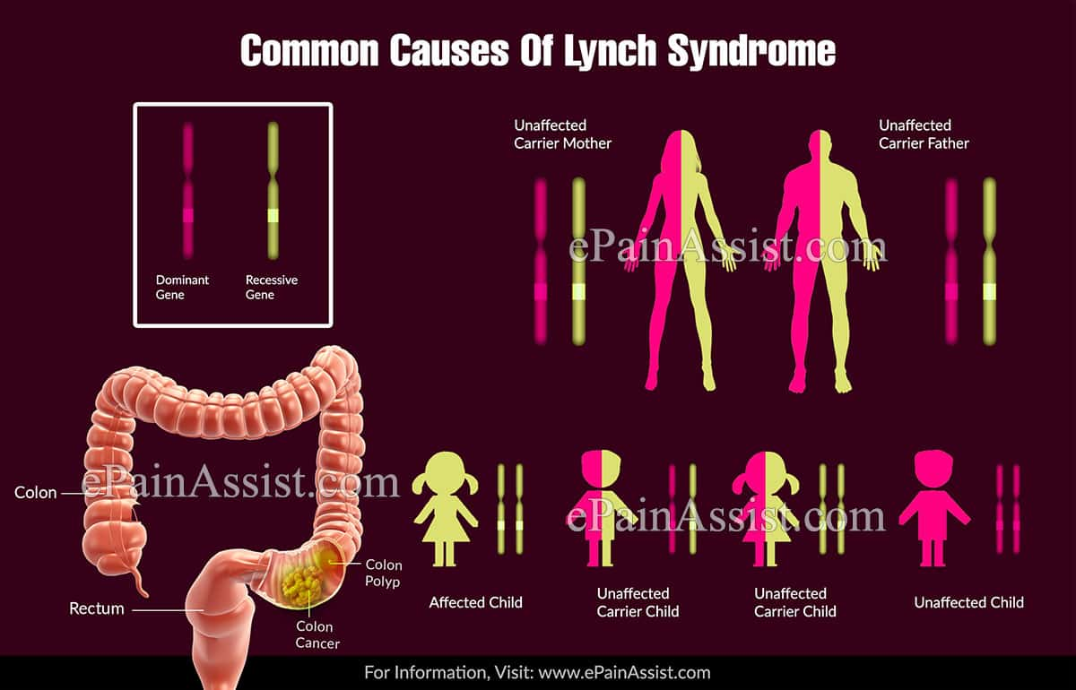 Common Causes Of Lynch Syndrome