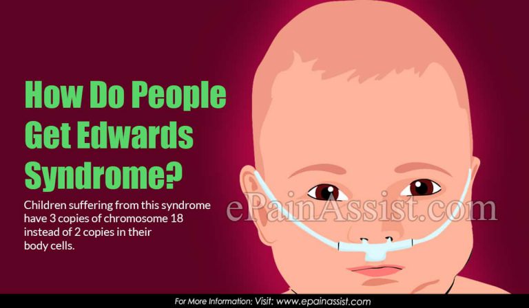 How Do People Get Edwards Syndrome?