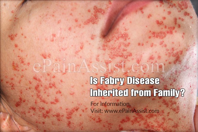 Is Fabry Disease Inherited From Family?