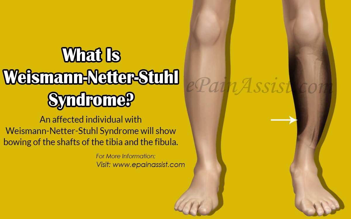What Is Weismann-Netter-Stuhl Syndrome?
