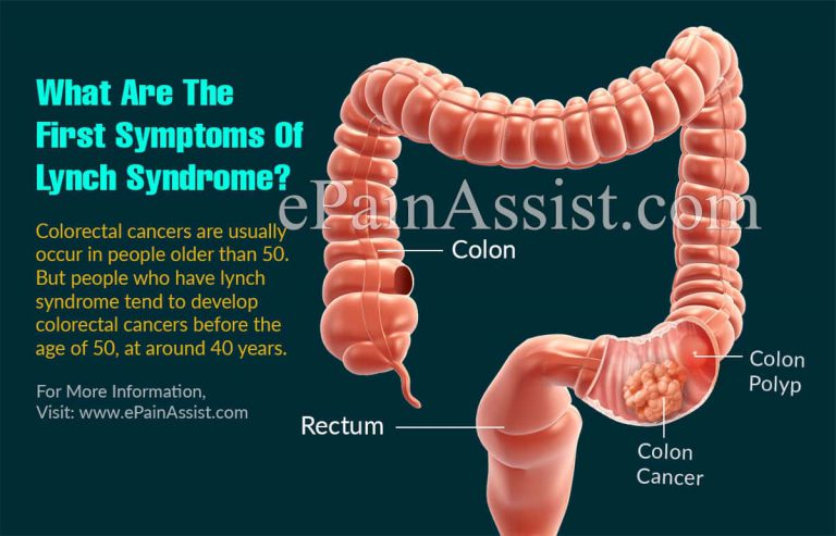 What Are The First Symptoms Of Lynch Syndrome?