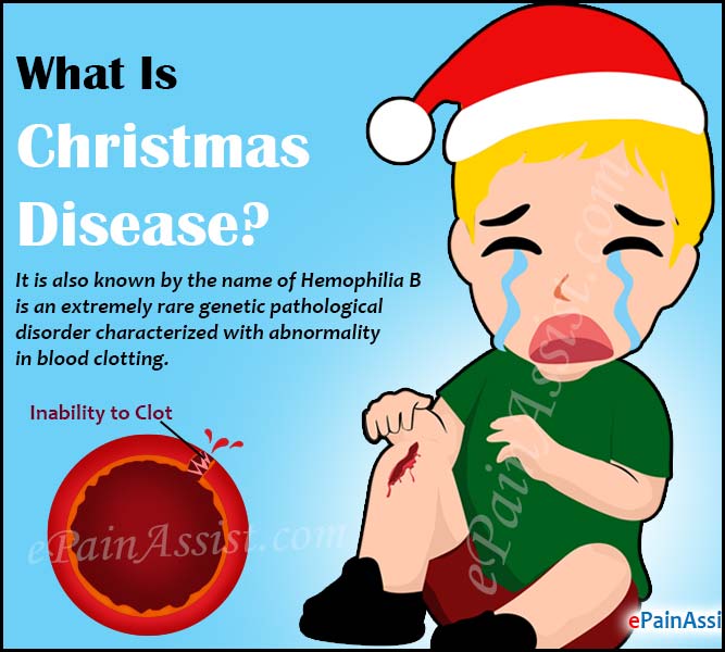 What Is Christmas Disease Or Hemophilia B Causes Symptoms Treatment Diagnosis