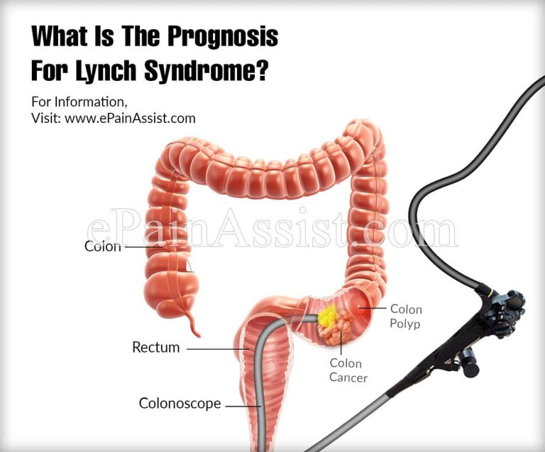 What Is The Prognosis For Lynch Syndrome?