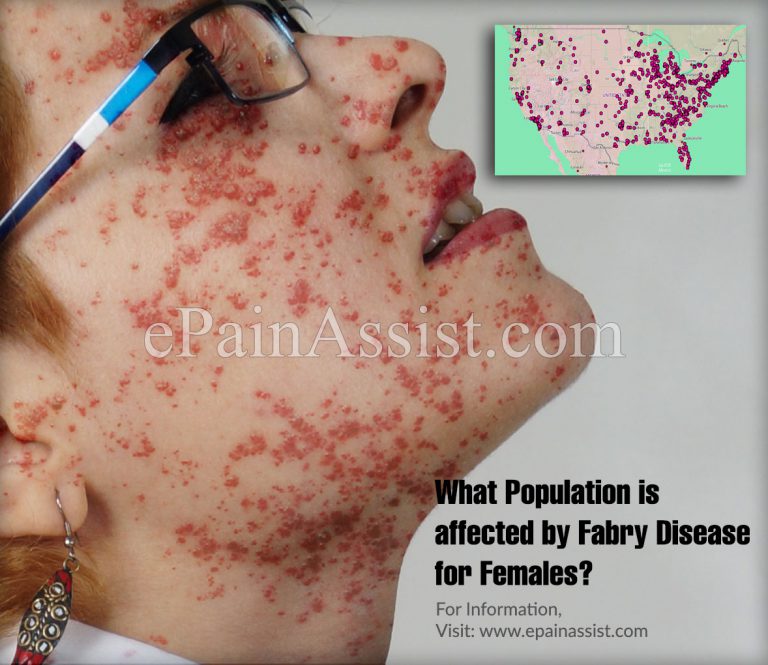 What Population Is Affected By Fabry Disease For Females?