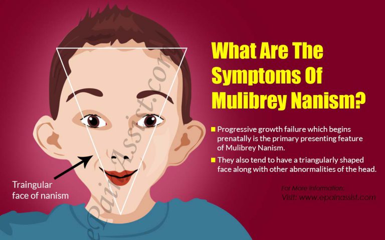 What is Mulibrey Nanism: Causes, Symptoms, Treatment