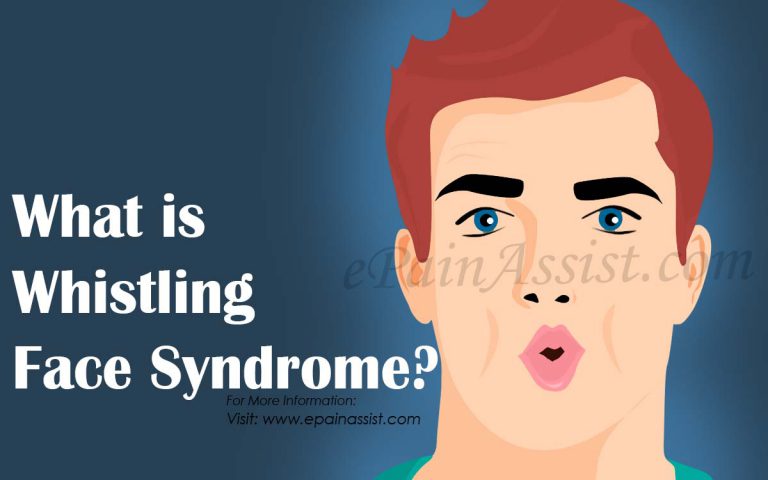 What is Whistling Face Syndrome: Causes, Symptoms, Treatment