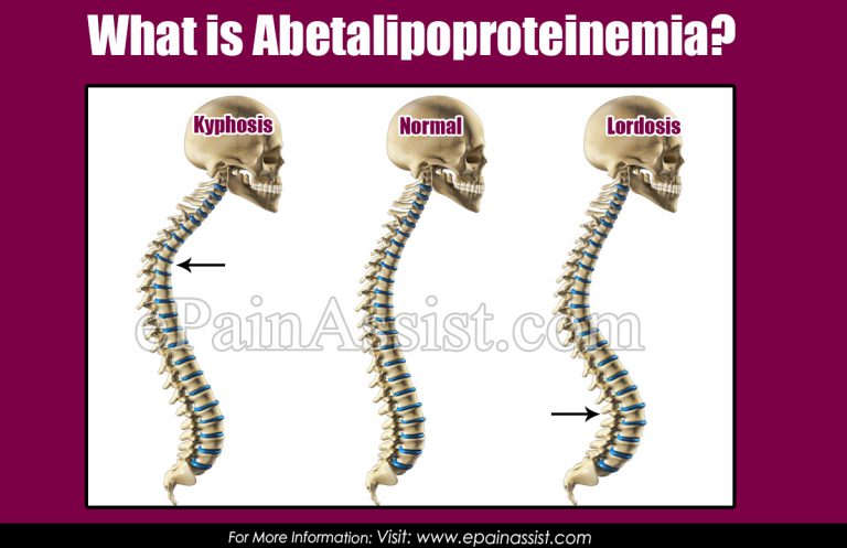 Abetalipoproteinemia: Causes, Symptoms, Treatment, Diagnosis