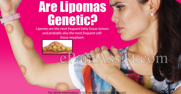 Are Lipomas Genetic?